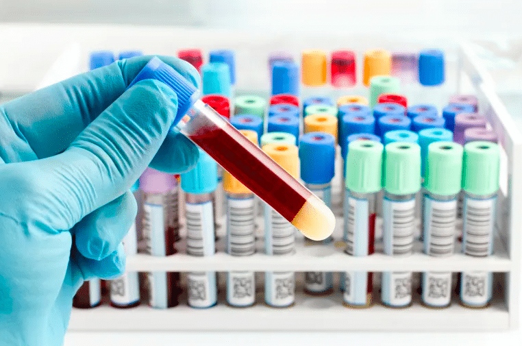 أنابيب بألوان مختلفة